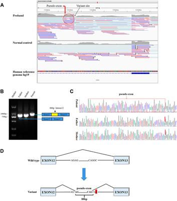 Identification of a Novel Deep Intronic Variant by Whole Genome Sequencing Combined With RNA Sequencing in a Chinese Patient With Menkes Disease